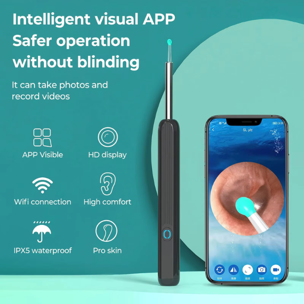 Smart Ear Wax Removal Camera