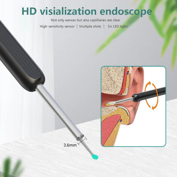 Smart Ear Wax Removal Camera