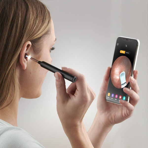 Smart Ear Wax Removal Camera