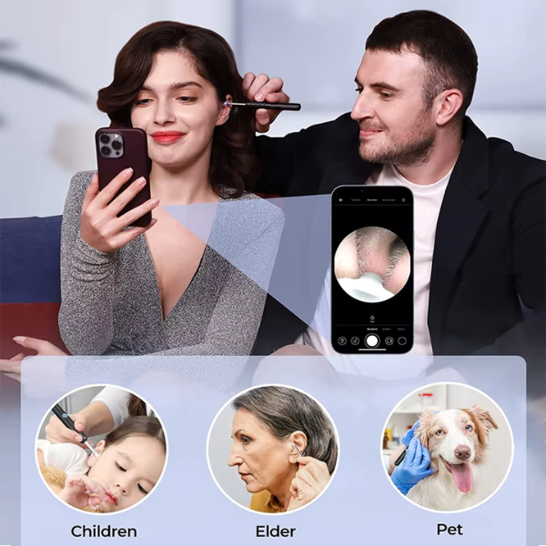 Smart Ear Wax Removal Camera