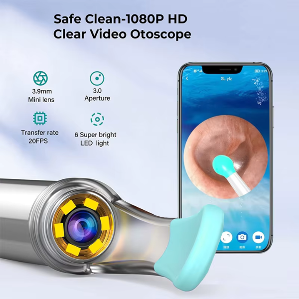 Smart Ear Wax Removal Camera